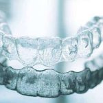 Tips for Maintaining Your Invisalign Aligners Throughout Treatment in London