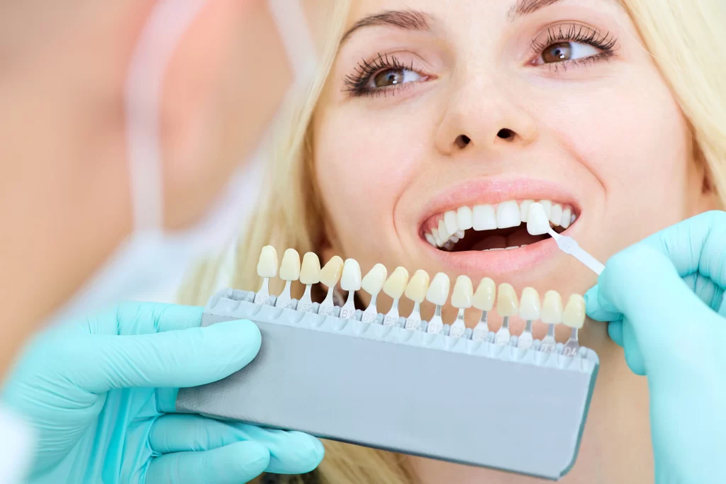 Brighter Smiles Ahead: Top Teeth Whitening Options in Macleod