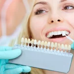 Brighter Smiles Ahead: Top Teeth Whitening Options in Macleod